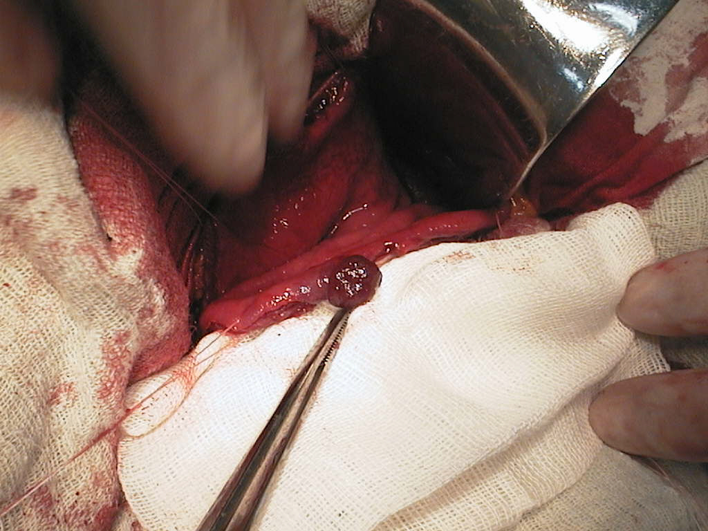 Polip gastric.